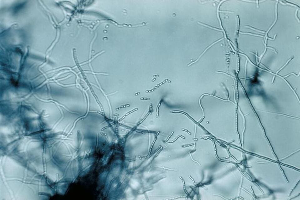 Ð¡ÑÑÐµÐ¿ÑÐ¾Ð¼Ð¸ÑÐµÑÑ (Ð»Ð°Ñ. Streptomyces) â ÑÐ¾Ð´ Ð°ÐºÑÐ¸Ð½Ð¾Ð±Ð°ÐºÑÐµÑÐ¸Ð¹ Ð¸Ð· ÑÐµÐ¼ÐµÐ¹ÑÑÐ²Ð° Streptomycetaceae. ÐÑÐ½Ð¾Ð²Ð½ÑÐ¼Ð¸ ÑÑÐµÐ´Ð°Ð¼Ð¸ Ð¾Ð±Ð¸ÑÐ°Ð½Ð¸Ñ ÑÐ²Ð»ÑÑÑÑÑ Ð¿Ð¾ÑÐ²Ð° Ð¸ ÑÐ»Ð¾Ð¸ Ð¼Ð¾ÑÑÐºÐ¾Ð¹ Ð²Ð¾Ð´Ñ.