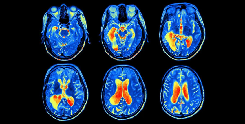 ÐÐ»Ð»ÑÑÑÑÐ°ÑÐ¸Ð²Ð½Ð¾Ðµ Ð¸Ð·Ð¾Ð±ÑÐ°Ð¶ÐµÐ½Ð¸Ðµ